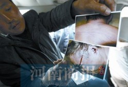 男子酒驾进警局做笔录后死亡尸体脸部有血迹